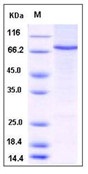 Human STAT4 Recombinant Protein (His Tag)(Discontinued)