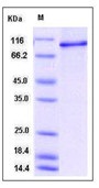 Human STAT6 Recombinant Protein (His Tag)(Discontinued)