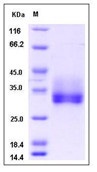 Human FGF18 / FGF-18 Recombinant Protein (His Tag)(Discontinued)