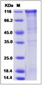 Human FSTL5 Recombinant Protein (Fc Tag)(Discontinued)