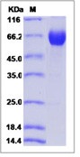 Human B7-H5 / Gi24 / VISTA Recombinant Protein (ECD, Fc Tag)(Discontinued)