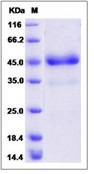 Human GITR / TNFRSF18 Recombinant Protein (Fc Tag)(Discontinued)