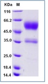 Human TMIGD2 Recombinant Protein (Fc Tag)(Discontinued)