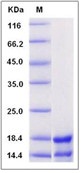 Human RASI-1 / MMP19 Recombinant Protein(Discontinued)