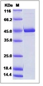 Human Citrate synthase / CS Recombinant Protein (His Tag)(Discontinued)