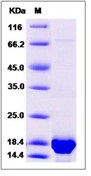 Human LC3A / MAP1LC3A Recombinant Protein (His Tag)(Discontinued)