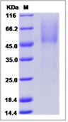 Human PARM1 / PARM-1 Recombinant Protein (His Tag)(Discontinued)