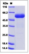 Human CPVL / Carboxypeptidase Recombinant Protein (His Tag)(Discontinued)