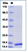 Human FGF4 Recombinant Protein(Discontinued)