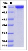 Human FGFR3 / CD333 Recombinant Protein (Fc Tag, ECD)(Discontinued)