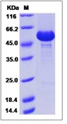 Human TNFRSF11A Recombinant Protein (Fc Tag)(Discontinued)