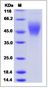 Human B7-H6 / B7H6 Recombinant Protein (His Tag)(Discontinued)