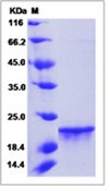 Human FGF-8b / FGF8B Recombinant Protein(Discontinued)