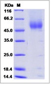 Human FGFR2 / CD332 Recombinant Protein (beta(IIIc), His Tag)(Discontinued)