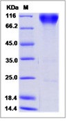 Human FGFR2 / CD332 Recombinant Protein (alpha(IIIb), Fc Tag)(Discontinued)