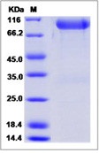 Human FGFR3 / CD333 Recombinant Protein (alpha(IIIb), Fc Tag)(Discontinued)