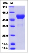 Human TL1A / TNFSF15 Recombinant Protein (Fc Tag)(Discontinued)