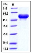 Mouse Arylsulfatase A / ARSA Recombinant Protein (His Tag)(Discontinued)