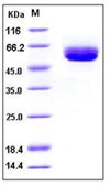 Mouse CD5L / CD5 antigen-like Recombinant Protein (His Tag)(Discontinued)