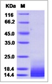 Mouse CCL12 / MCP-5 Recombinant Protein (His Tag)(Discontinued)