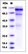 Mouse HGF / Hepatocyte Growth Factor Recombinant Protein(Discontinued)