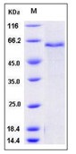 Mouse ADAM9 Recombinant Protein (His Tag)(Discontinued)