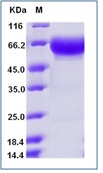 Mouse PD1 / PDCD1 / CD279 Recombinant Protein (Fc Tag)(Discontinued)