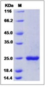 Mouse FGF7 / FGF-7 / KGF Recombinant Protein (His Tag)(Discontinued)