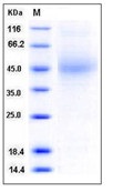 Mouse CD48 / SLAMF2 / BCM1 Recombinant Protein (His Tag)(Discontinued)