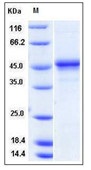 Mouse PDGF-C / SCDGF Recombinant Protein (Fc Tag)(Discontinued)