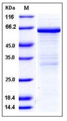 Mouse MMP-8 / CLG1 Recombinant Protein(Discontinued)