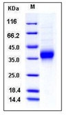 Mouse Ephrin-A2 / EFNA2 Recombinant Protein (His Tag)(Discontinued)