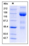 Mouse VEGFR3 / FLT-4 Recombinant Protein (Fc Tag)(Discontinued)