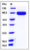 Mouse EphA2 Recombinant Protein (His Tag)(Discontinued)