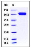 Mouse EphA7 / EHK-3 Recombinant Protein (His Tag)(Discontinued)