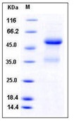 Mouse Ephrin-A1 / EFNA1 Recombinant Protein (Fc Tag)(Discontinued)