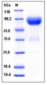 Mouse Ephrin-B2 / EFNB2 Recombinant Protein (Fc Tag)(Discontinued)