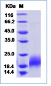 Mouse PDGF-B / PDGF-2 Recombinant Protein (His Tag)(Discontinued)