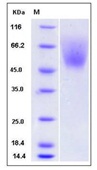 Mouse SIRP alpha / CD172a Recombinant Protein (His Tag)(Discontinued)