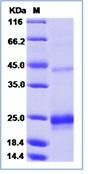 Mouse TNFSF14 / LIGHT / CD258 Recombinant Protein (His Tag)(Discontinued)