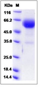 Mouse BTLA Recombinant Protein (Fc Tag)(Discontinued)