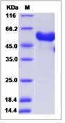 Mouse Ephrin B3 / EFNB3 Recombinant Protein (ECD, Fc Tag)(Discontinued)