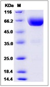 Mouse TIM3 / HAVCR2 Recombinant Protein (Fc Tag)(Discontinued)