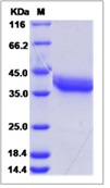 Mouse MMP-2 / MMP2 Recombinant Protein (His Tag)(Discontinued)