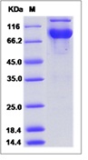 Mouse LAG3 / CD223 / Lymphocyte activation gene 3 Recombinant Protein (Fc Tag)(Discontinued)