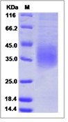 Mouse CD47 Recombinant Protein (His Tag)(Discontinued)