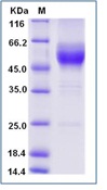 Mouse GITR / TNFRSF18 Recombinant Protein (Fc Tag)(Discontinued)