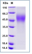 Mouse CD30 / TNFRSF8 Recombinant Protein (His Tag)(Discontinued)