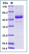 Rift Valley fever virus (RVFV) (strain MP12) glycoRecombinant Protein / Gc Recombinant Protein (His Tag)(Discontinued)