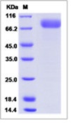 Ebola virus EBOV (subtype Bundibugyo, strain Uganda 2007) GlycoRecombinant Protein / GP-RBD (Receptor Binding Domain) Recombinant Protein (Fc Tag)(Discontinued)